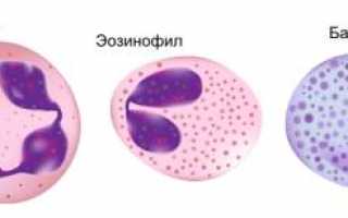 О чем говорят повышенные базофилы у ребенка?