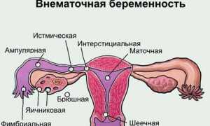 Узнаем, как отличить месячные от кровотечения