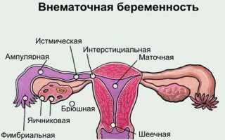 Узнаем, как отличить месячные от кровотечения