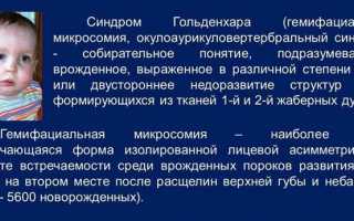 Опасные последствия синдрома Гольденхара и методы лечения патологии