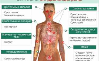 Причины и методы терапии при синдроме Шегрена