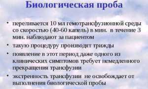 Все про биологическую пробу при переливании крови