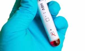 Рассказываем про анализ крови на антиген HBsAg