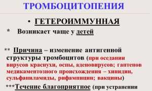 Вся информация про иммунную тромбоцитопению