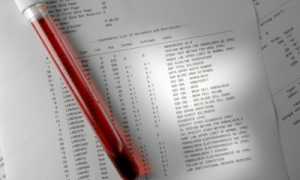 Действия при повышенном уровне аспартатаминотрансферазы
