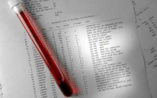 Действия при повышенном уровне аспартатаминотрансферазы