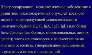 Все про миеломную болезнь