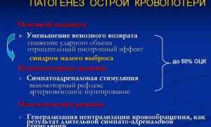 Классификация и причины острой кровопотери