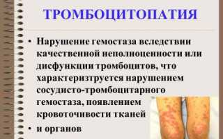 Вся информация про тромбоцитопатию