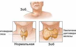 Узнаем все про повышенный тиреоглобулин