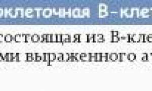 Вся информация про B клеточную лимфому