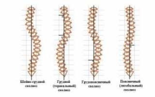 Сколиоз грудного отдела позвоночника – симптомы и лечение
