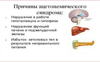 Признаки ацетонемического синдрома и методы лечения патологии