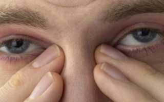 Что делать если глаза болят и чешутся