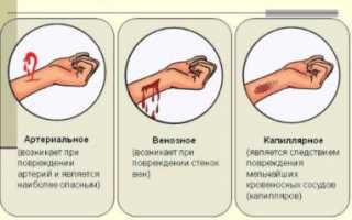 Узнаем все степени кровопотери