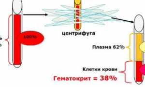 Причины пониженного гематокрита при беременности и методы его корректировки
