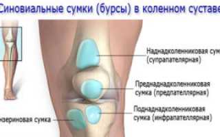 Бурсит: лечение, диагностика и профилактика заболевания