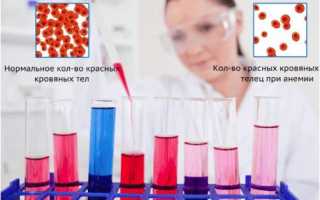 Все про анализы крови при железодефицитной анемии