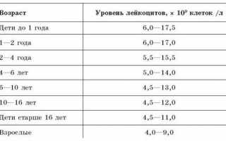 Узнаем, как понизить лейкоциты в крови
