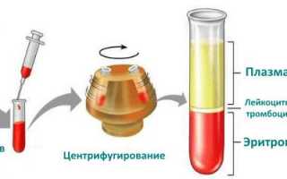 Вся информация про определение гематокрита