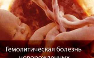 Узнаем все про гемолитическую болезнь новорожденных