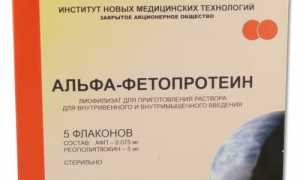 Все, что нужно знать о том что такое анализ на альфа фетопротеин