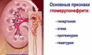 Узнаем, что значит понижение общего белка в крови