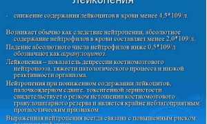 Вся информация про лейкопению