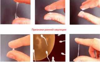 Почему перед месячными появились слизистые выделения?