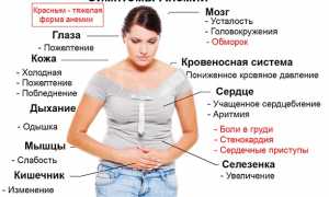 Все про симптомы и методы лечения анемии у женщин