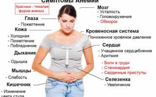 Все про симптомы и методы лечения анемии у женщин