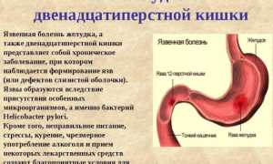 О чем может говорить рвота с кровью