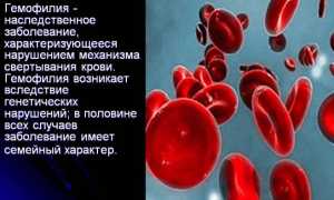 Причины и лечение гемофилии