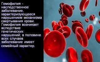 Причины и лечение гемофилии