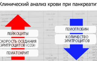 Важная информация про анализы при панкреатите