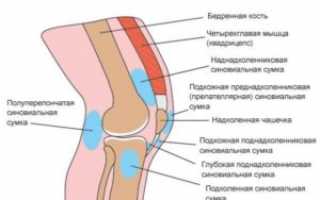 Как лечить бурсит коленного сустава в домашних условиях?