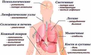 Разберемся в симптомах рака крови у мужчин