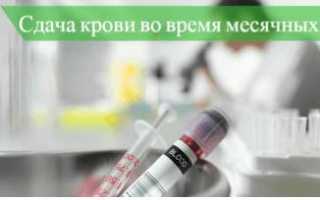 Расскажем, можно ли во время месячных сдавать кровь на анализы
