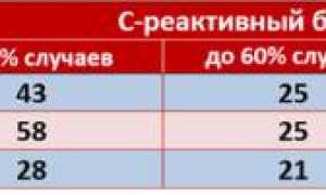 Причины повышения С реактивного белка