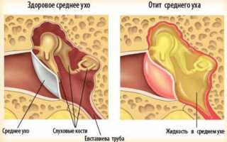 Почему может идти кровь из уха?
