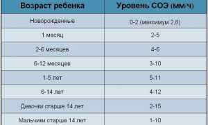 Узнаем нормы СОЭ у детей