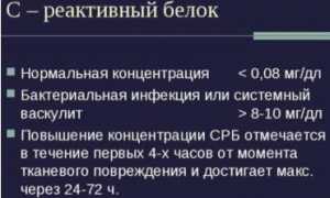 Узнаем нормы С реактивного белка