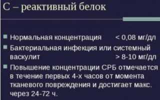 Узнаем нормы С реактивного белка