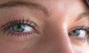 Чешутся и гноятся глаза