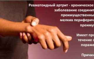 Узнаем нормы ревматоидного фактора