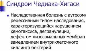 Вся информация про синдром Чедиака-Хигаси