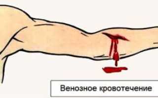 Как оказывать первую помощь при венозном кровотечении?