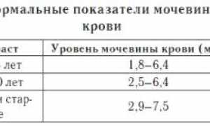 Все про повышенную мочевину в крови у женщин