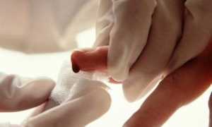 Какие значения лимфоцитов у детей считаются нормой?