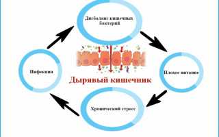 Проявления синдрома дырявого кишечника и методы лечения патологии